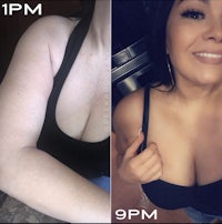 before and after photos of a woman's breasts