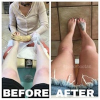 two pictures of a woman's feet before and after getting a tattoo